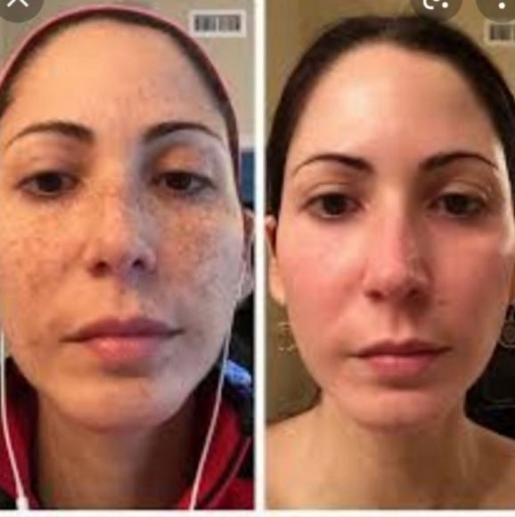 Obagi vitamic C serum set of 3 New - Picture 3 of 15